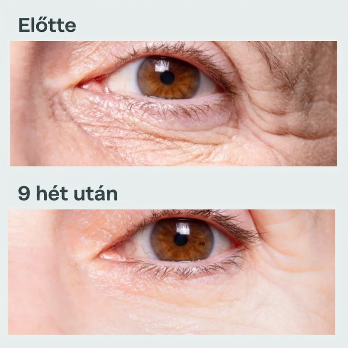 Eredmény 9 hét után