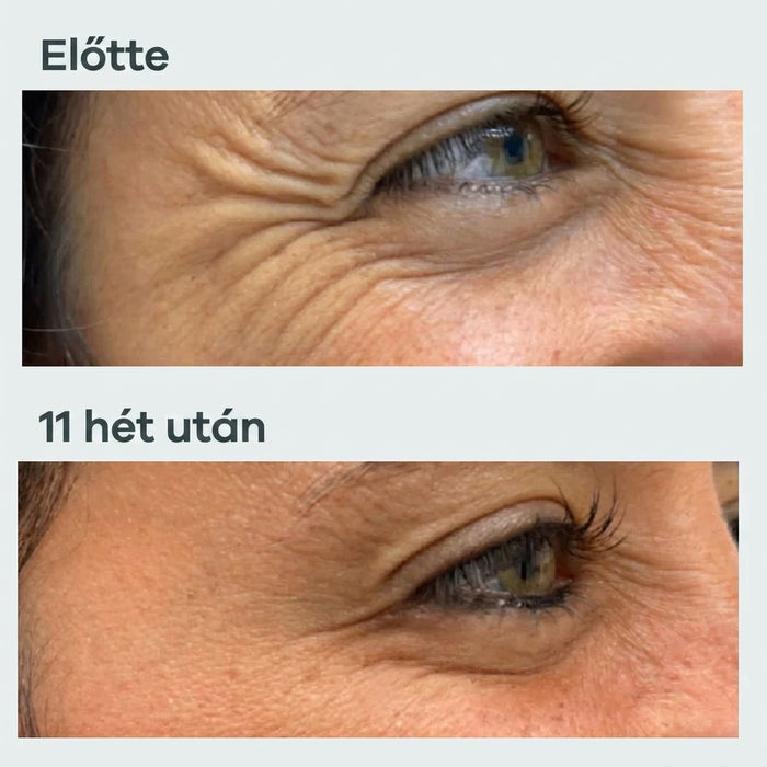 Eredmény 11 hét után