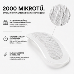 2 000 micro-aiguilles